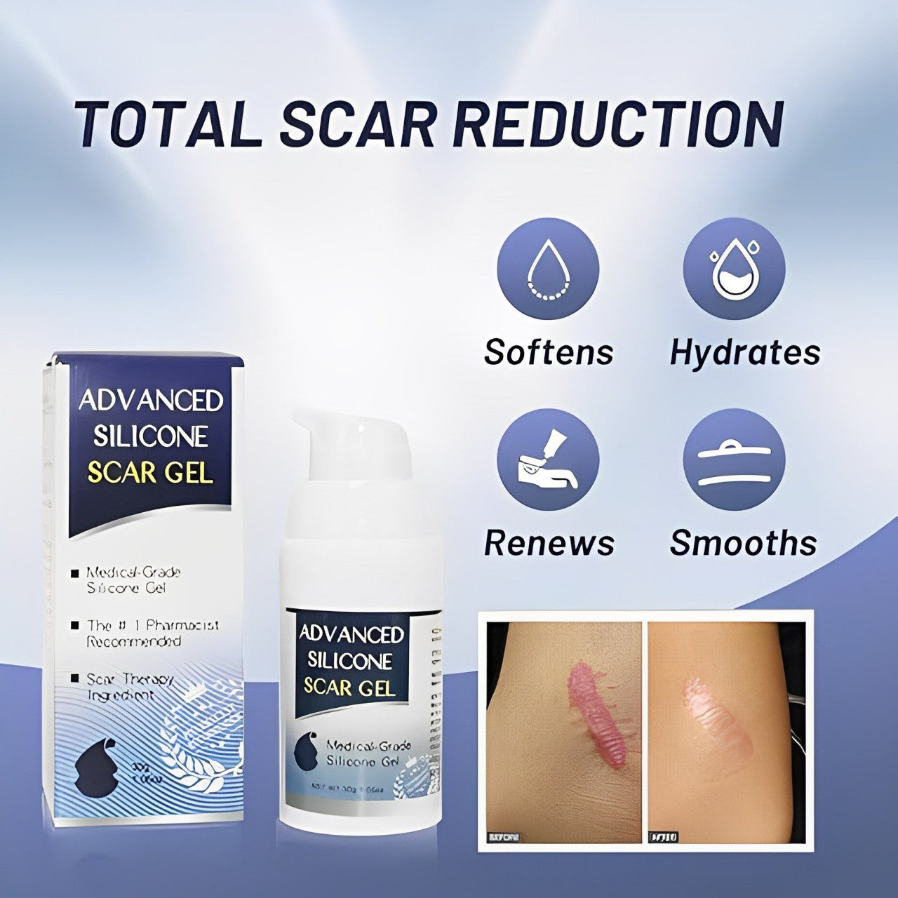 Unlock Confidence: Fade Scars Away with Our Powerful Scar Removal Gel!