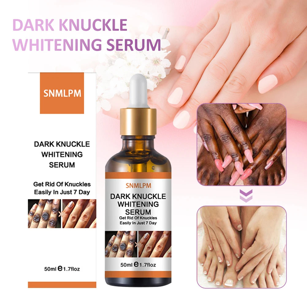 Radiant Touch: Illuminate Your Skin with Our Fast-Acting Dark Knuckles Lightening Serum